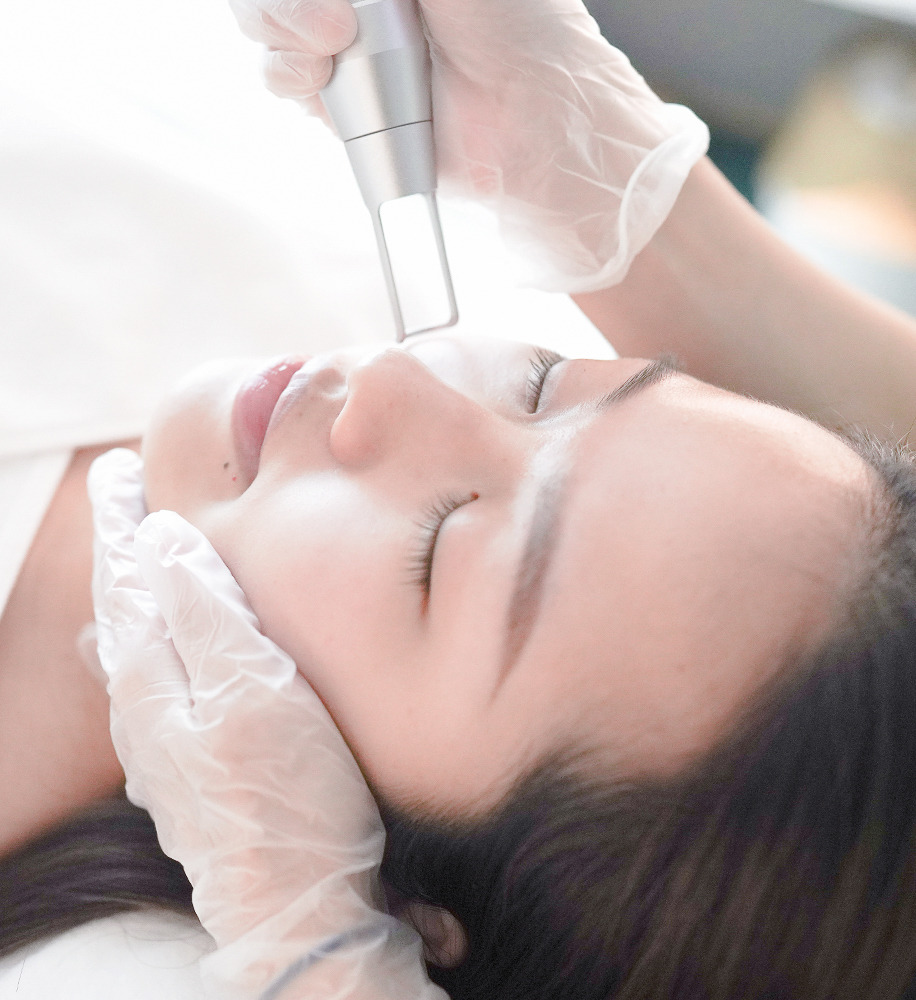 Baby Faced Pico Laser - Skin Retreat