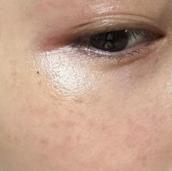 202510 Blog35 太陽斑
