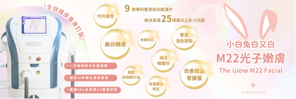Blog28 2