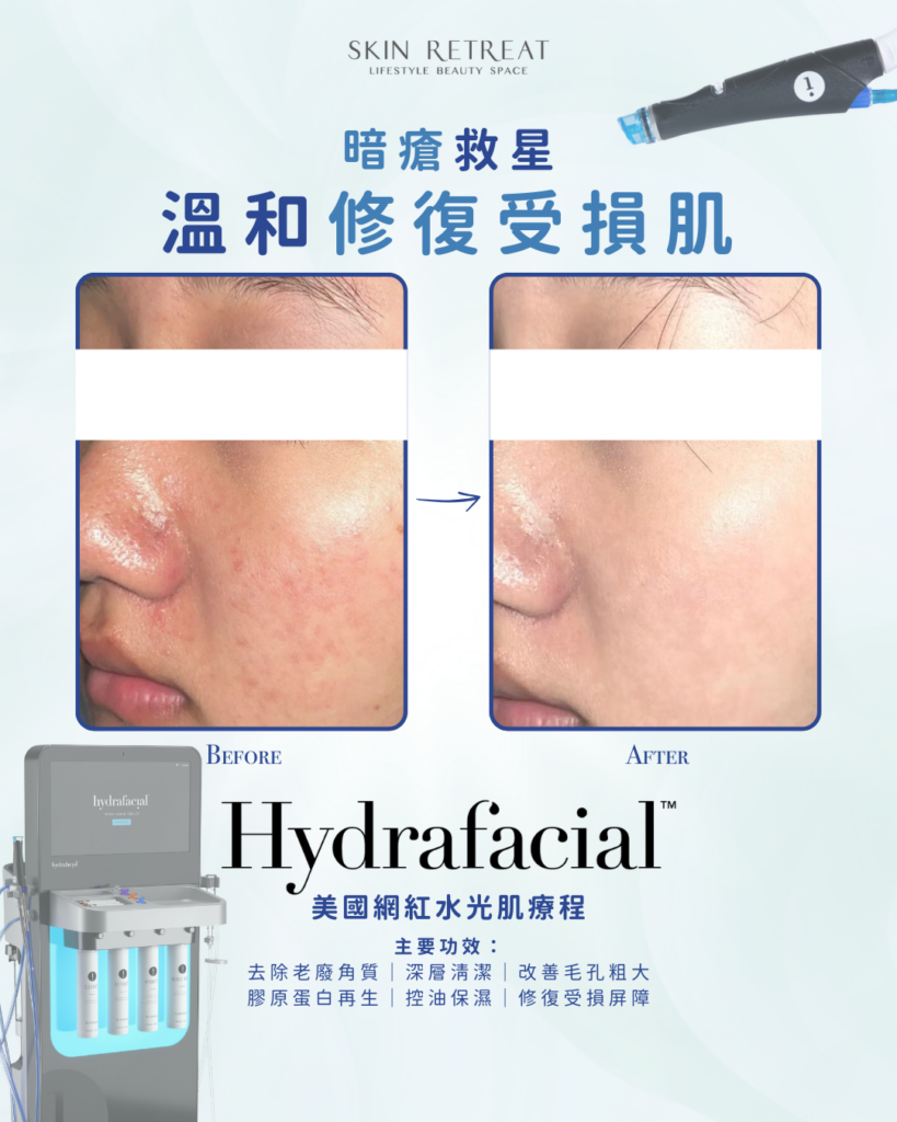 2026 Sr Jan Ig Post (1080 X 1350 Px) (2)