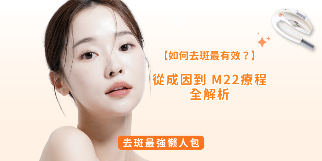 Sr Blog Banner (1)
